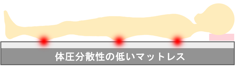 体圧分散の低いマットレス
